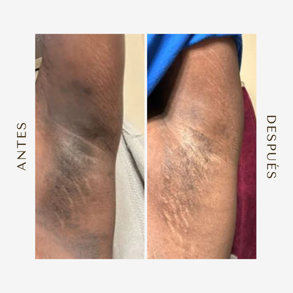 Dr. Melaxin - Spray Despigmentante y Exfoliante