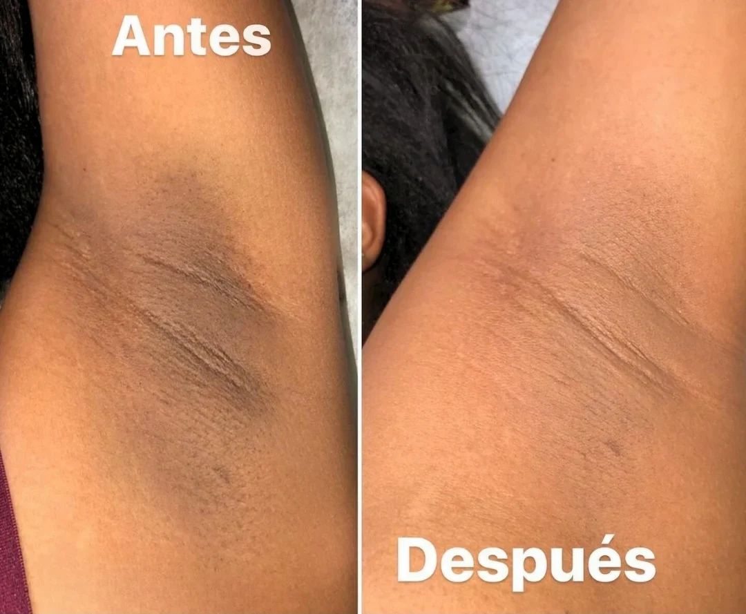 Dr. Melaxin - Spray Despigmentante y Exfoliante