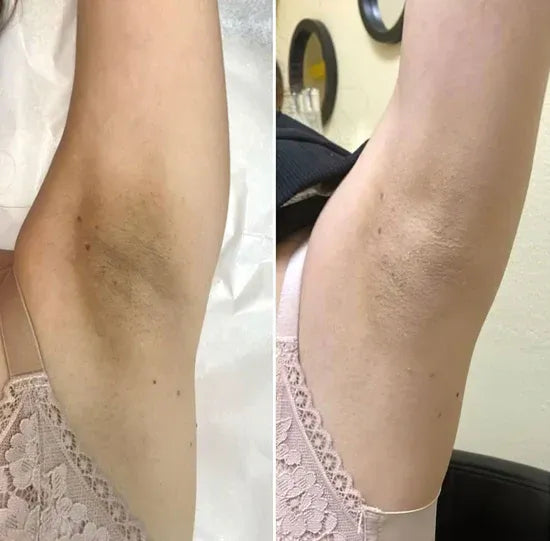 Dr. Melaxin - Spray Despigmentante y Exfoliante